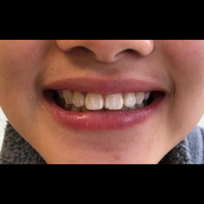  after